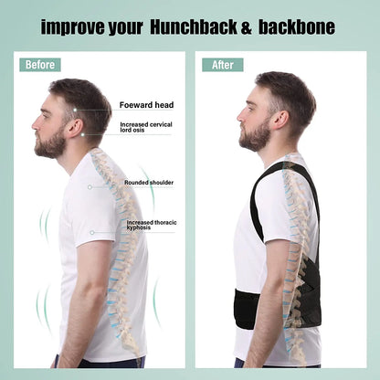 Bokeds Back Brace Posture Corrector